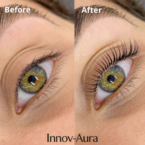 Innov-Aura™ Heated Eyelash Curler