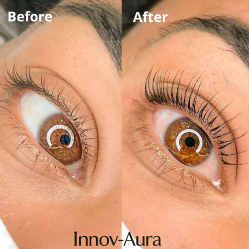 Innov-Aura™ Heated Eyelash Curler